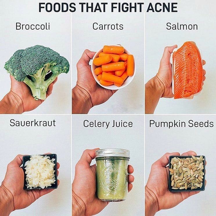 Foods that fight Acne